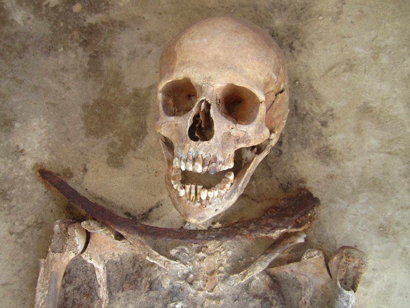 09. Esqueleto de mulher enterrada com foice na garganta. Polónia, secs XVII e XVIII.